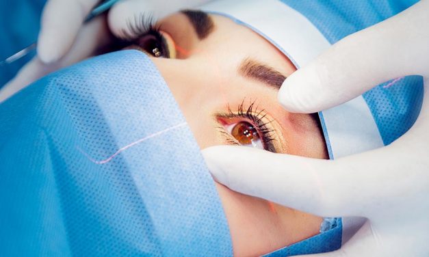 Review: ogen laseren met TransPRK. Het vervolg tot nu